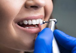 Gloved hand using instrument to clean teeth