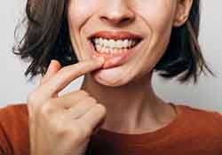 a woman showing signs of gum disease