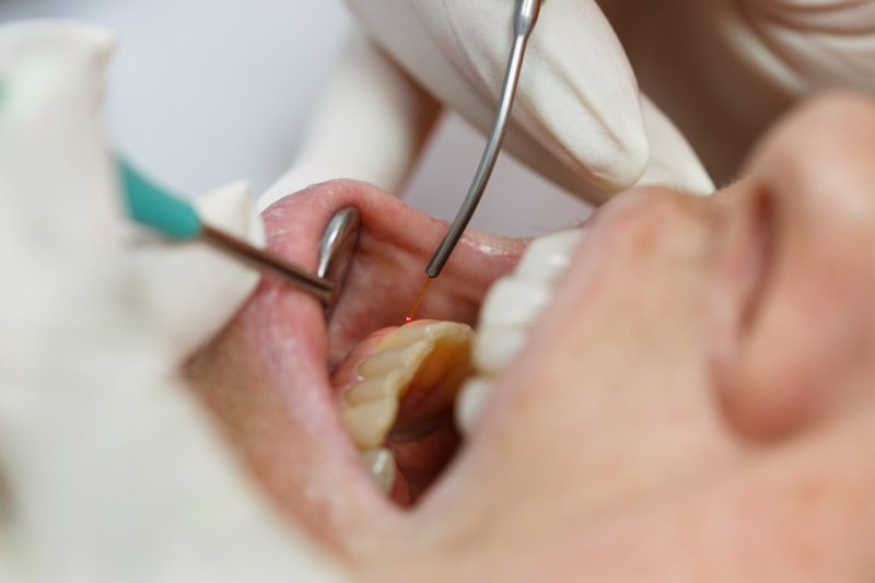 Dentist using a laser